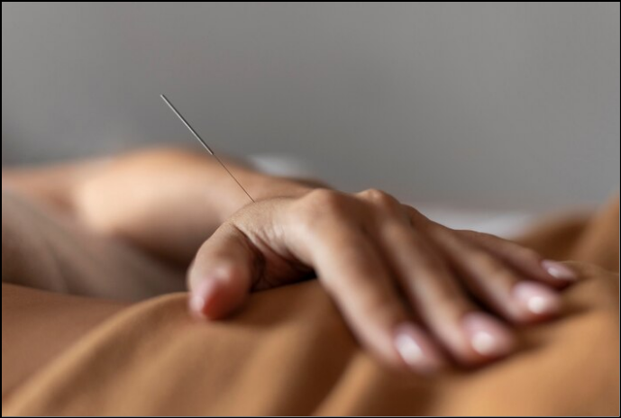 ACUPUNCTURE TREATMENT